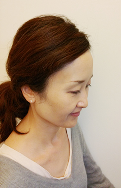 ����E�E�C�b�O�̂����k�͖k���R�T������